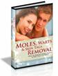 How To Get Rid Of Skin Tags | How “Moles Warts Removal” Helps People...